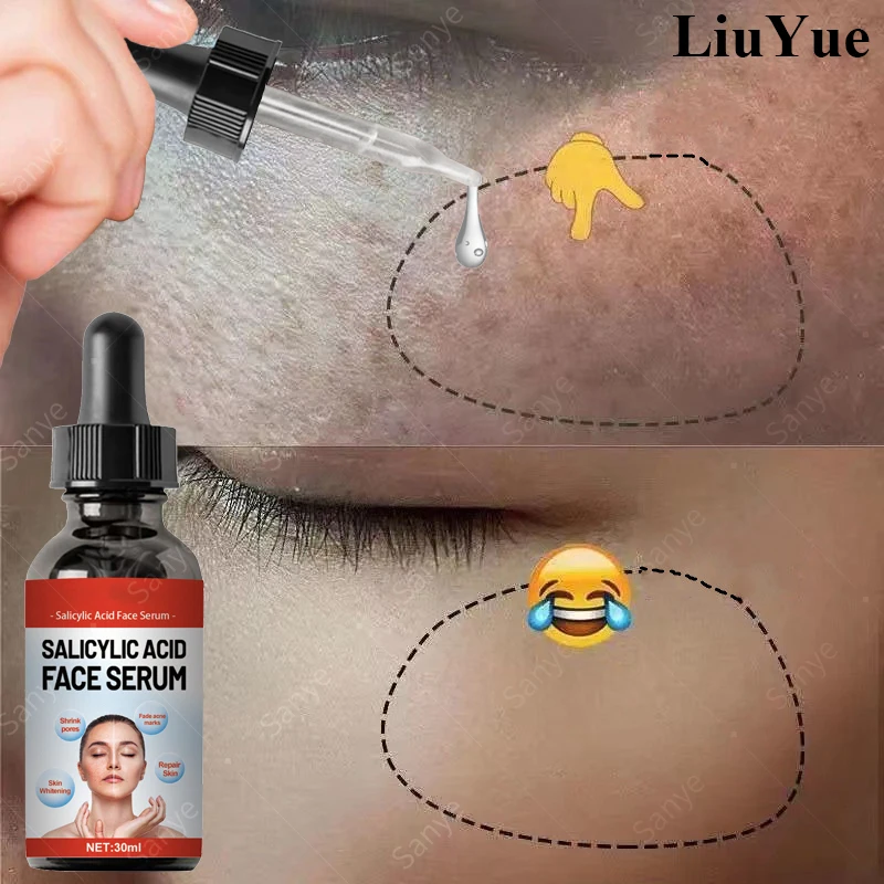 Salicylic Acid Facial Essence Remove Dark Spot Freckle Serum Face Fade Melanin Whitening Essence Pore Shrink Brighten Moisturize