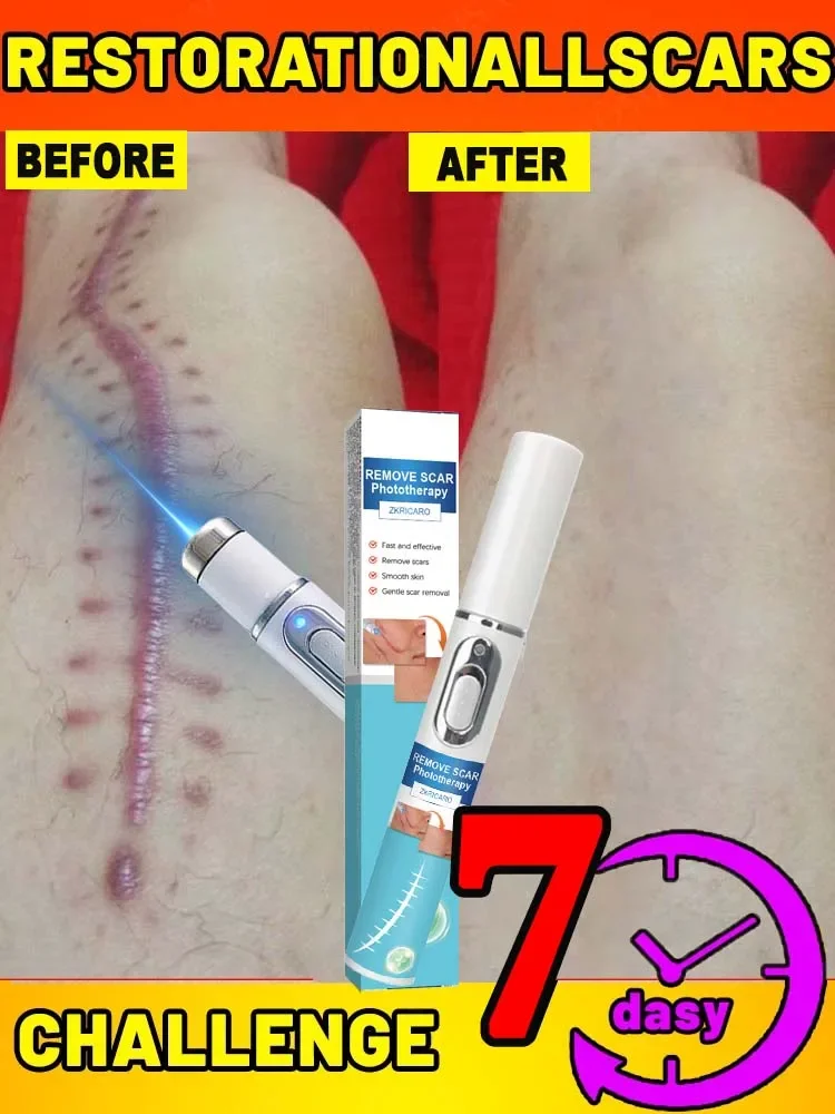 Produits les plus vendus pour l’élimination des cicatrices au laser