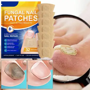 32 pz Patch per la riparazione delle unghie Adesivo per la correzione dell'unghia del piede Recupero della paronichia Strumenti per pedicure Nastro di protezione delle unghie divise 1