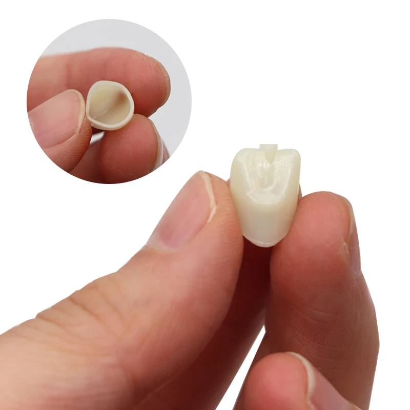 Coroa Dental Temporária para Clareamento dos Dentes,