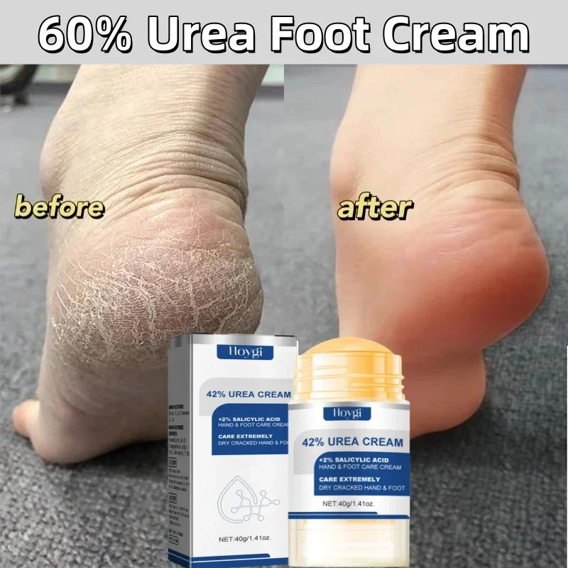 60% Urea Foot Cream Aloe Vera Ultra-hydrating Softening Dry Cracked Feet Cream Gentle Exfoliation Daily Foot Care Solution 40g foot cream