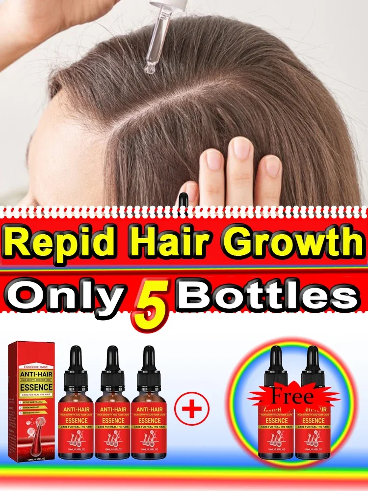 

Unisex Hair Growth Oil Hair Loss Treatment Rapid Effective Baldness Repair Hereditary Postpartum Hair Loss