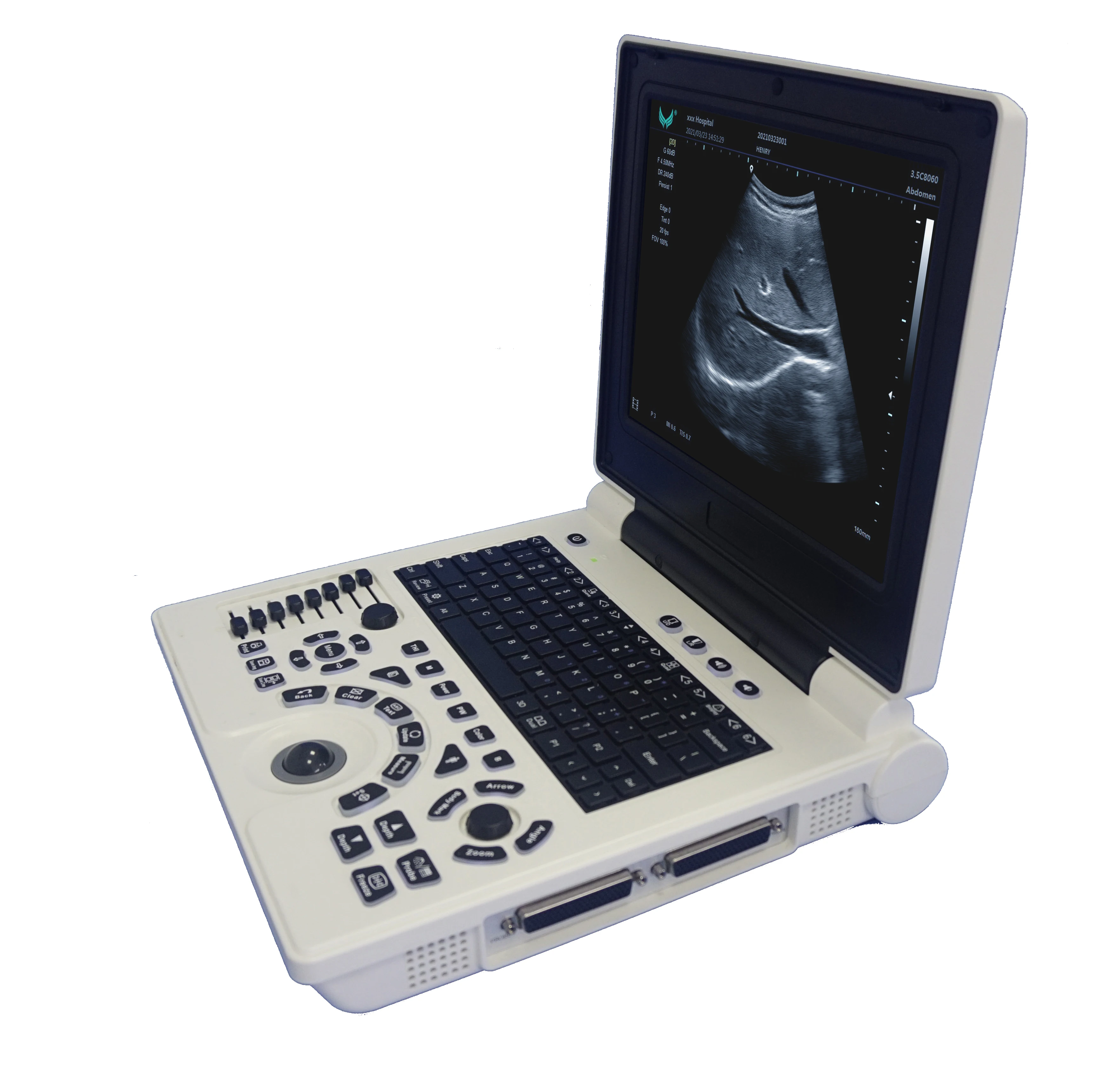 

Diagnostic System Wireless Probe Scanner Medical Ultrasound Mobile For Pregnant Women portable ultrasound