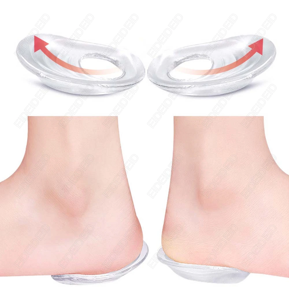 정형외과용 실리콘 젤 깔창, XO 다리 교정용 힐 패드, 발바닥 근막염 통증 완화 발 관리용 깔창 패드