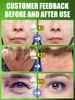 Rediscover Youthful Glow 3