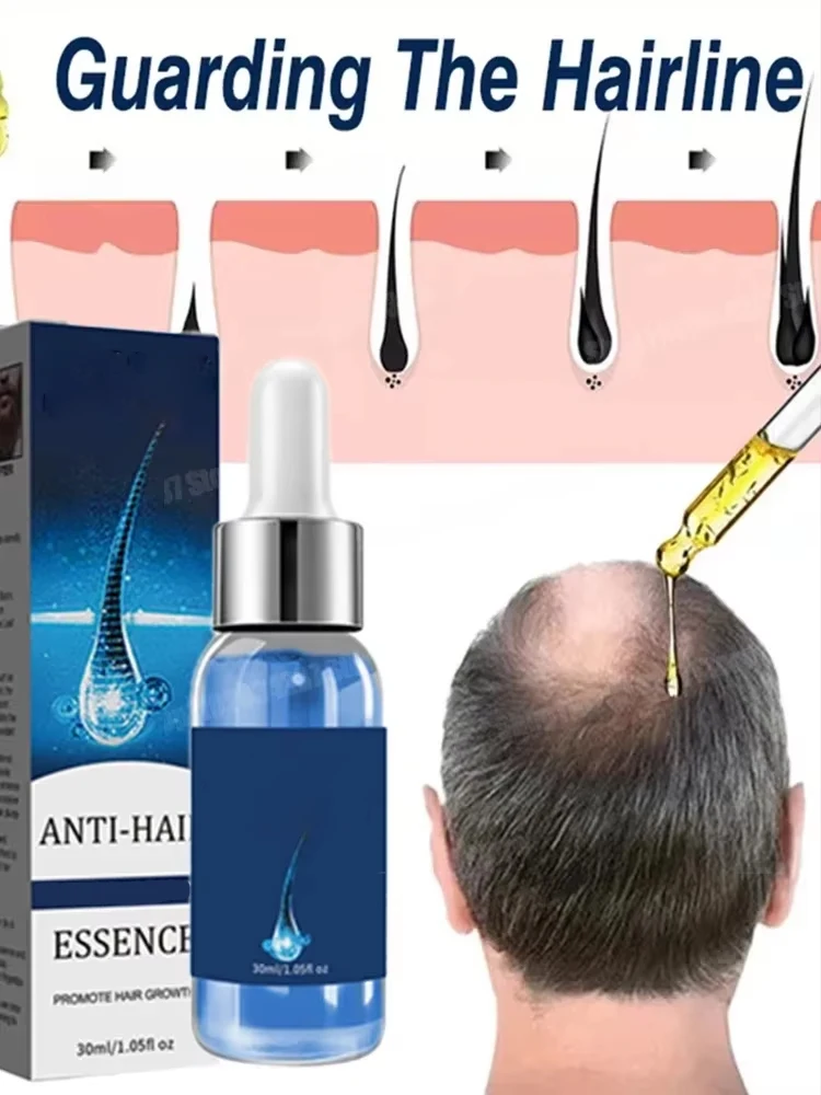 Hair Care Oil Nourish Hair for Men Women Ginger Natural Anti Loss Scalp Serum