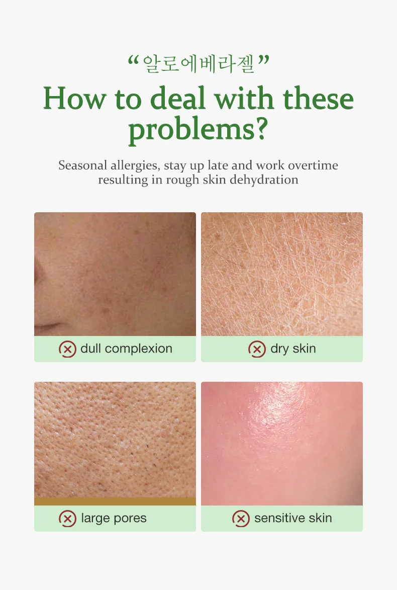 Horn Moisturizing Aloe Gel After Sun Repair Soothing Moisturizing Reduce Skin Damage Aloe Gel