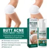 Butt Acne Treatmen Cream Buttock Pimple Removal Clearing Buttock Thigh Acne Moisturize Smoothing Nourish Body Acne Repair Cream 6