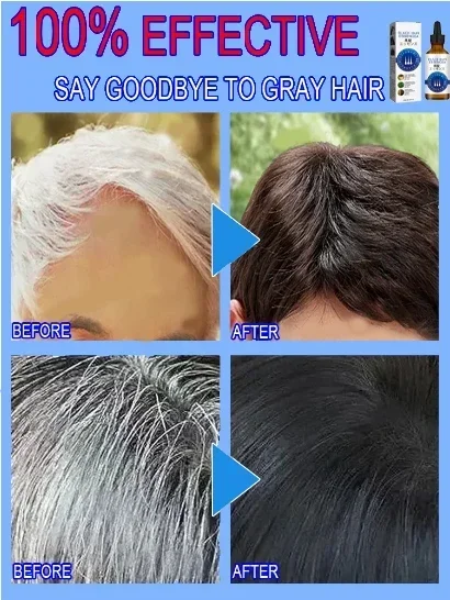 White hair killer remove gray hair restore natural color 7 days hair coloring product