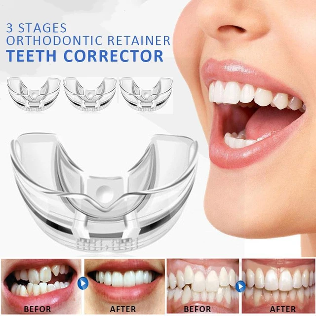 Appareil orthodontique en silicone, bretelles dentaires, 11%, entraîneur,  retenue des dents, bruxisme, protège-dents, lisseur, chaud - AliExpress