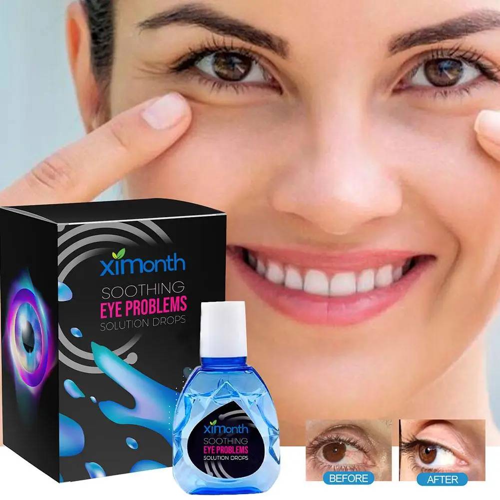 

10ml Treatment EyeProblems SolutionDrops Eye Soothing Eye Drops Relieve Eye Circles Dark Improve Fatigue New Remove Eyesigh T9B8