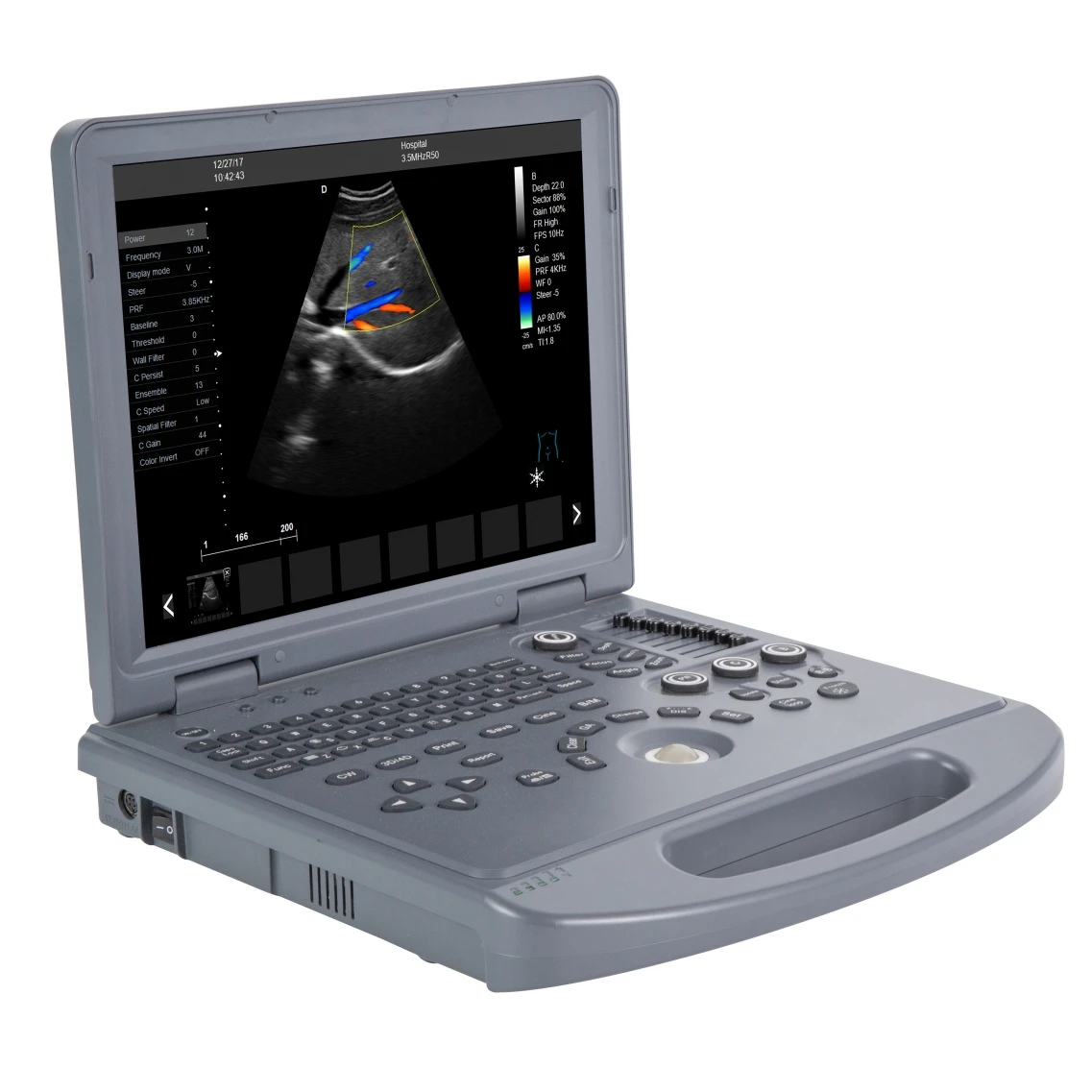 Prezzo Conveniente Ecografo Laptop Eco Color Doppler Ultrasound Machine Con Sonda Convessa