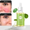 7 Day Repair Redness Serum Sooth Itching Sensitive Skin Improve Rosacea Shrink Pore Smooth Nourish Facial Skin Korean Cosmetics 6