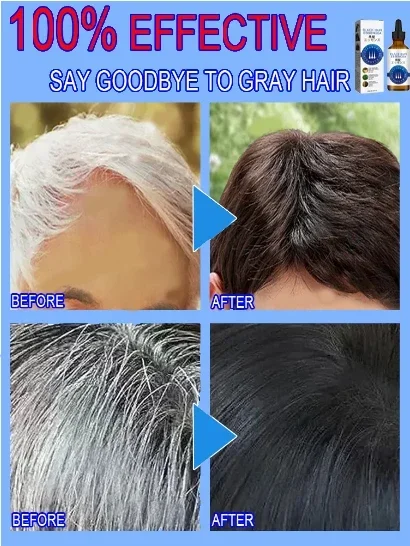 S&eacute;rum Anti-Cheveux Gris Rem&egrave;de Assombrissant Blanc