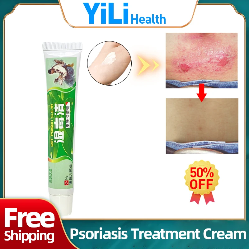 

Psoriasis Eczema Treatment Cream Dermatitis Eczematoid Skin Herbal Ointment Red Rash Fungus Anti-itch Tinea Versicolor Remover