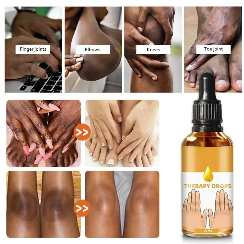 Dark Knuckles Fast Brighten Serum Elbows Hand Knuckle Brightening Serum Knee Black Skin Quickly Lighten Stains Remover Essence 2