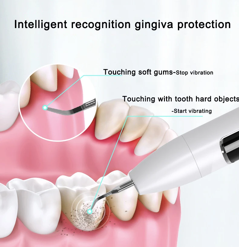 Xiaomi Visual Ultrasonic Dental Calculus Remover Teeth Plaque Scaler Stain Clean Electric dental cleaner dental scaler