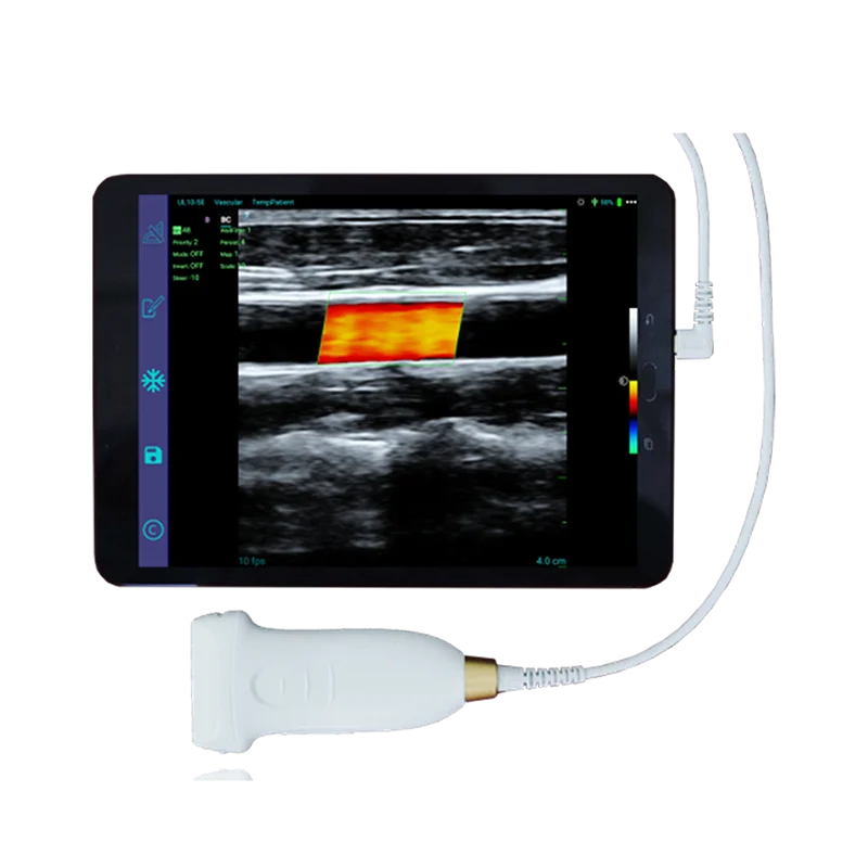 

Amain Medische Benodigdheden Magiq MCUL10-5E Handheld Kleur Doppler En Ce-certificering Lineaire Sonde Ultrasound