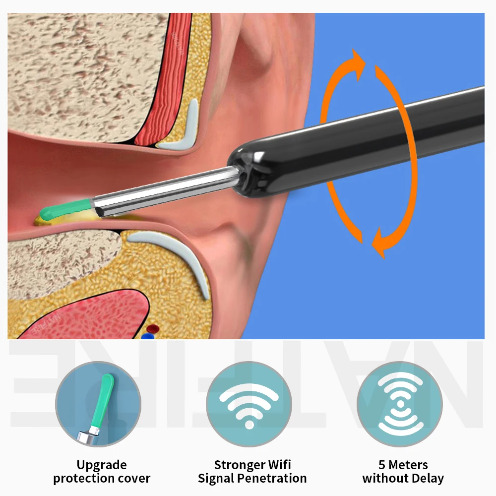 와이파이 비주얼 귀 클리너 카메라 포함, 6 LED 조명, 3.6mm 미니 귀 왁스 제거 도구, 비디오 촬영 HD 귀이개