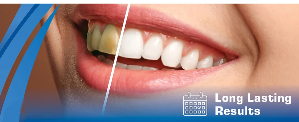 Dentifrice violet pour blanchiment des dents et anti-taches_voghion.com