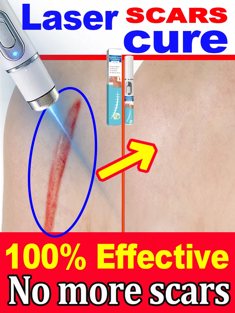LASER SCAR Potent delete 2