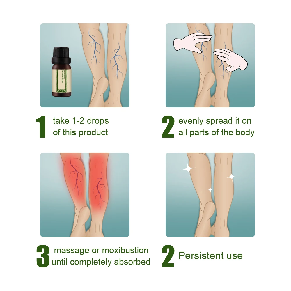 All-Natural Vari-Cure Serum All-eelhoe Varicose Vein Treatment For Treatment Legs Care