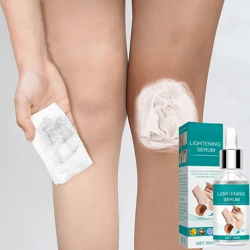 Skin Whitening Serum Private Parts Underarm Bleaching Serum Whiten Butt Knee Brighten Inner Thigh Arm Body Remove Dark Melanin 4