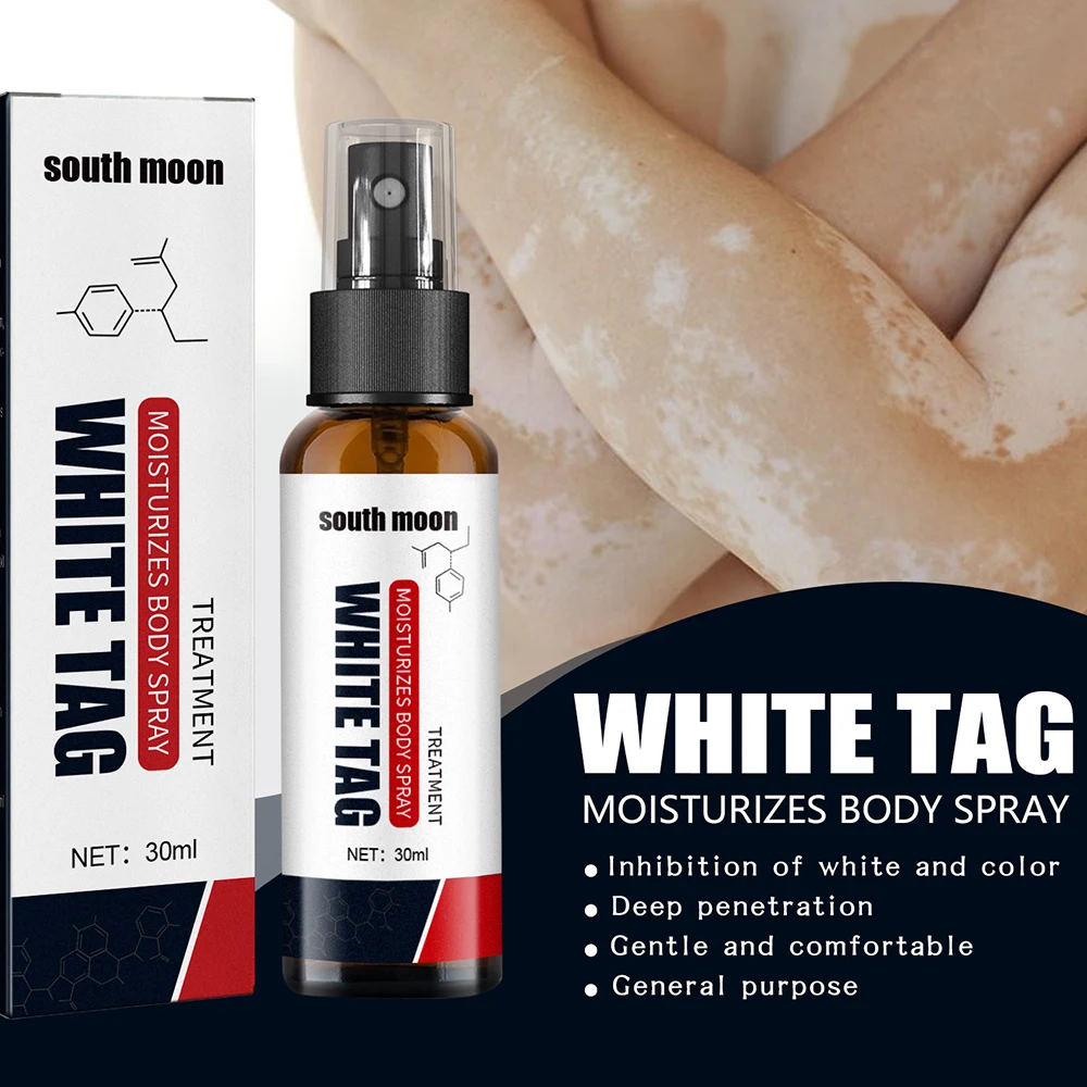 

Moisture Body Spray White Tag Disease Treatment Ointment Repair Cream Vitiligo Herbal Extraction Skin Care Balm 30ml