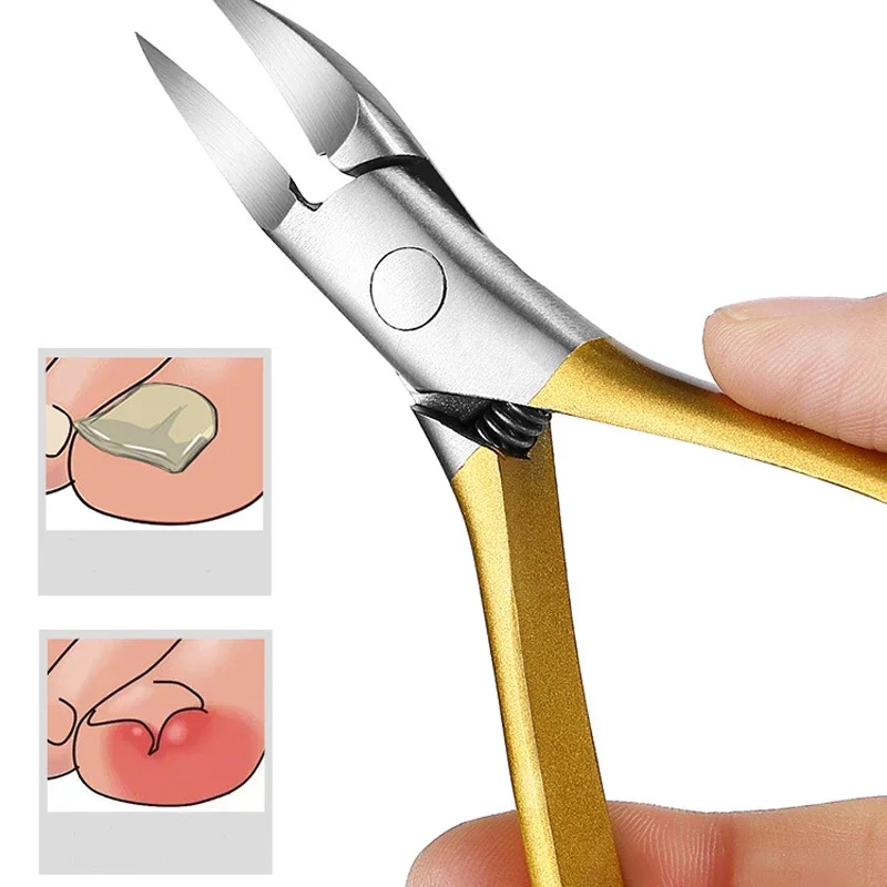 Nail Clippers Ingrown Toenail Scissors Podiatry Correction Nippers Cuticle Cutters Cut Paronychia Pedicure Foot Care Tool toe nail clipper,nail clipper set,nail clipper,nail care kit,nail scissors set,nail clippers,manicure pedicure kit,manicure set,manicure sets,manicure nail clipper set
