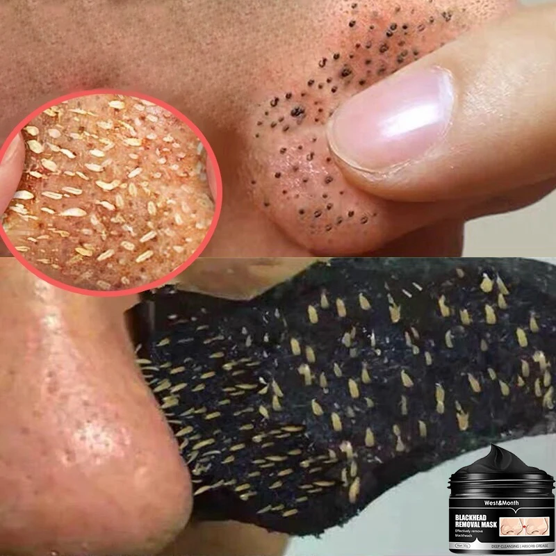 Рисунок 2 - Маска для удаления черных точек унисекс