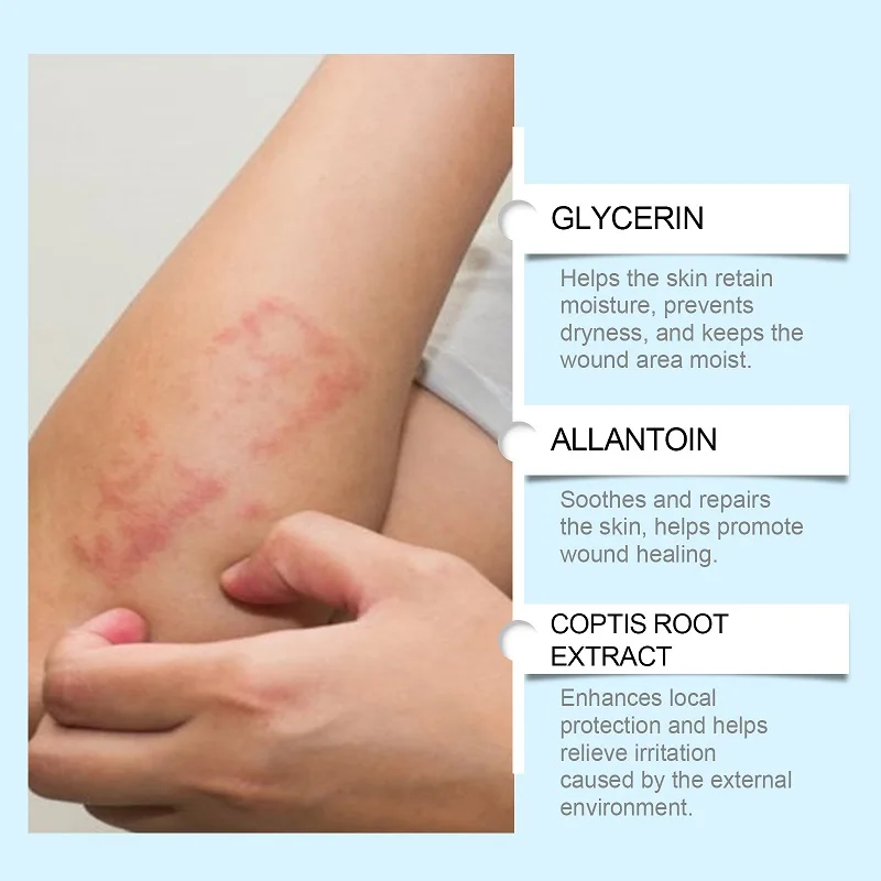 Bedsores Treatment Cream Removal Rot Myogenic Pressure Sores Ulcer Festering Wound Healing Anti Infection Necrotic Skin Ointment
