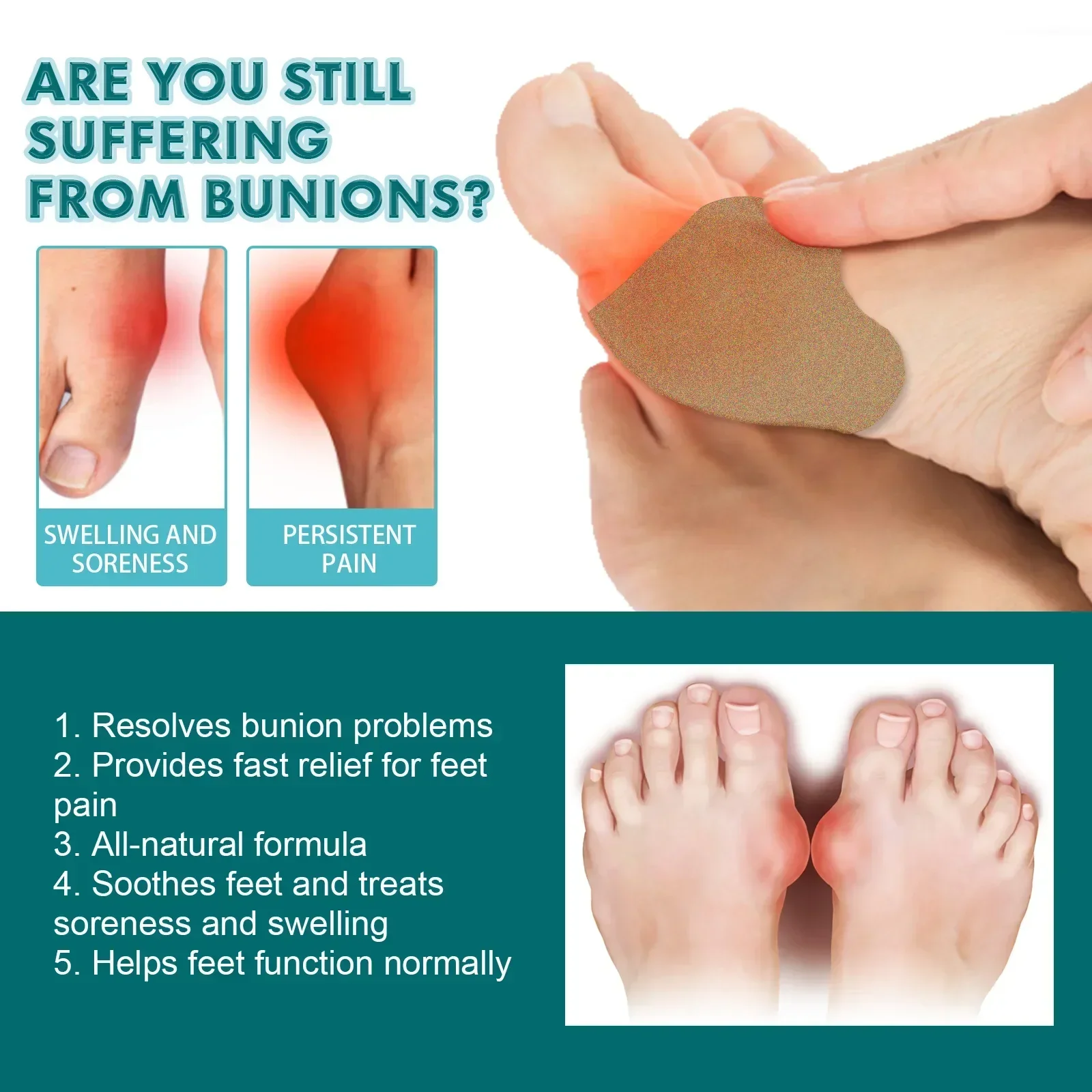 Bunion Pain Relief Patch Feet Bone Thumb Corrector Arthritis Foot Gout Swelling Treatment Medical Plaster Toe Pain Patch 6pcs/bo