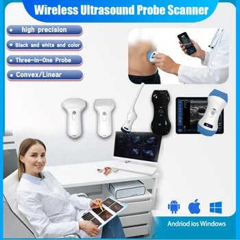 Ecografo Portatile Wireless con Sonda, Valigetta Inclusa, Compatibile con WIFI iOS Android Windows