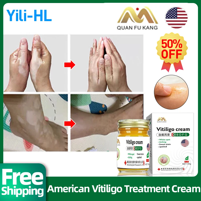 

Vitiligo Treatment Cream Skin White Spot Disease Remover Leg Sweat Spots Removal Spray Promote Melanin Repair American Medicine