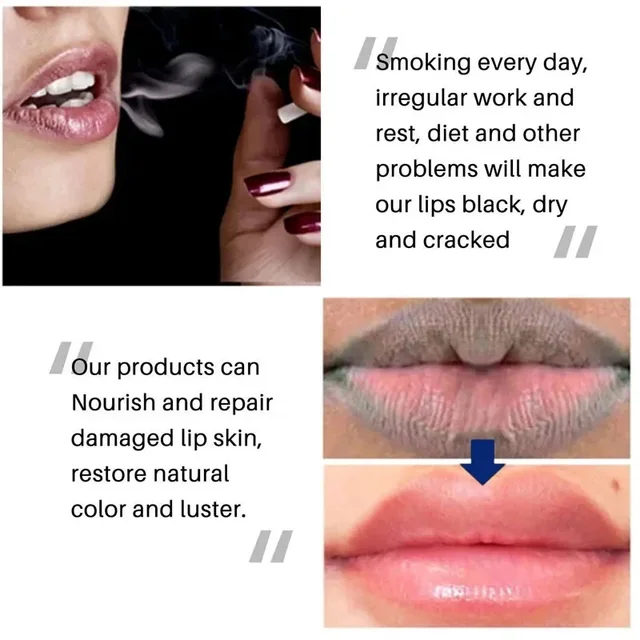 Fast Lightening Pink Mouth Lips Serum Bleaching Permanent Remove Dark Smoke Lips Lip Balm Moisturize Gloss Lipstick Lip Oil