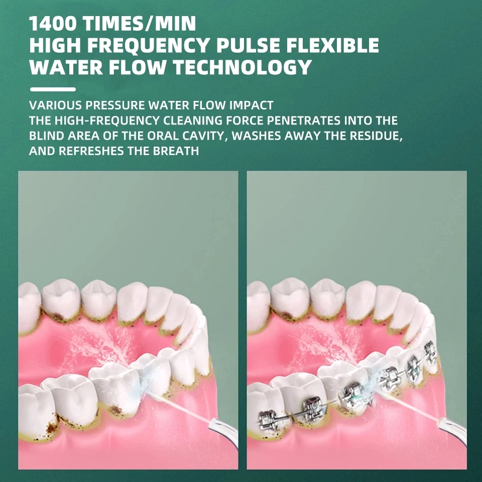 Xiaomi Electric Tooth Cleaner Oral Irrigator Rechargeable Water Jet Teeth Cleaner Whitening Food Grade Dental Teeth Cleaner
