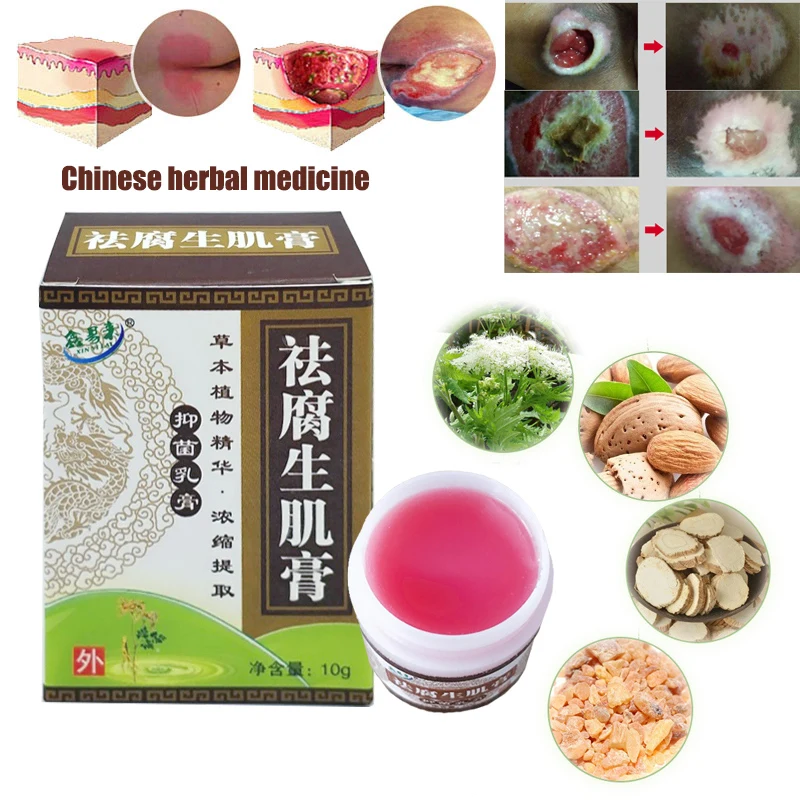 

1PC Herbal Removal Rot Myogenic Cream Bedsores Paste Treat Pressure Sores/Decubituses/Pressure Ulcer Festering Wound Healing