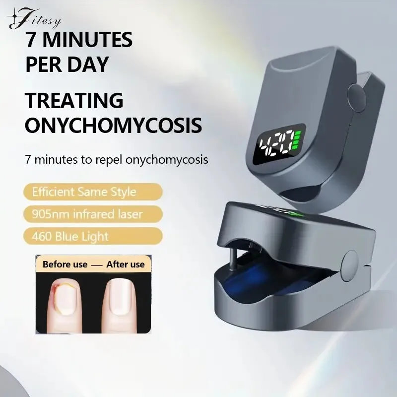 Nail Fungus Treatment Device with Time Display 470nm950nm wavelength Fast-acting Anti Fungal Laser Device for Finger/Toenails