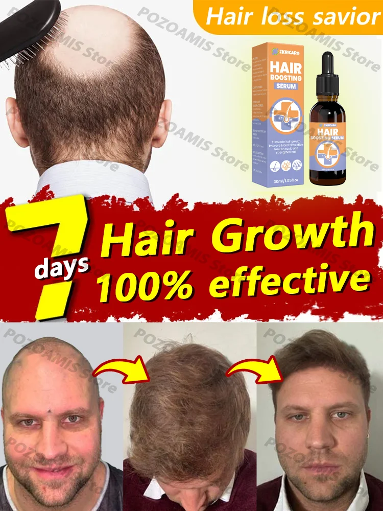 100% Natural Vegetable-based Hair Growth Essential Oil 3-day Hair Growth