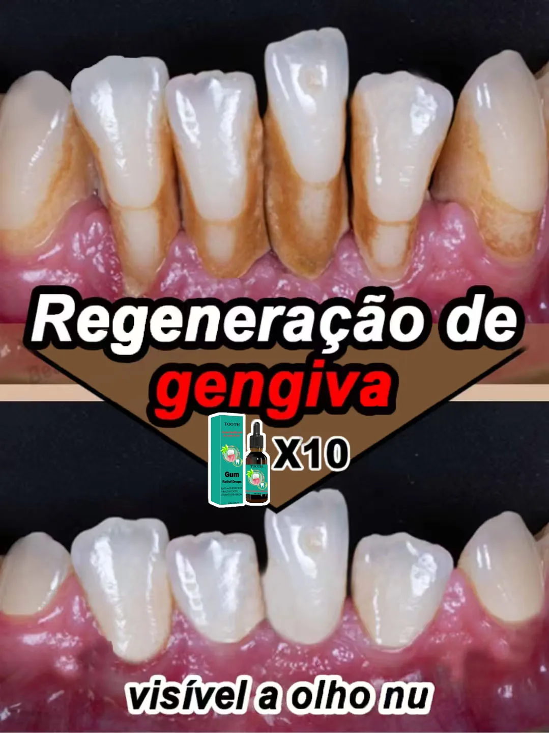 R&eacute;parer les probl&egrave;mes de gencives endommag&eacute;es,soulager la douleur,renforcer probl&egrave;mes de gencives, restaurer salet&eacute;