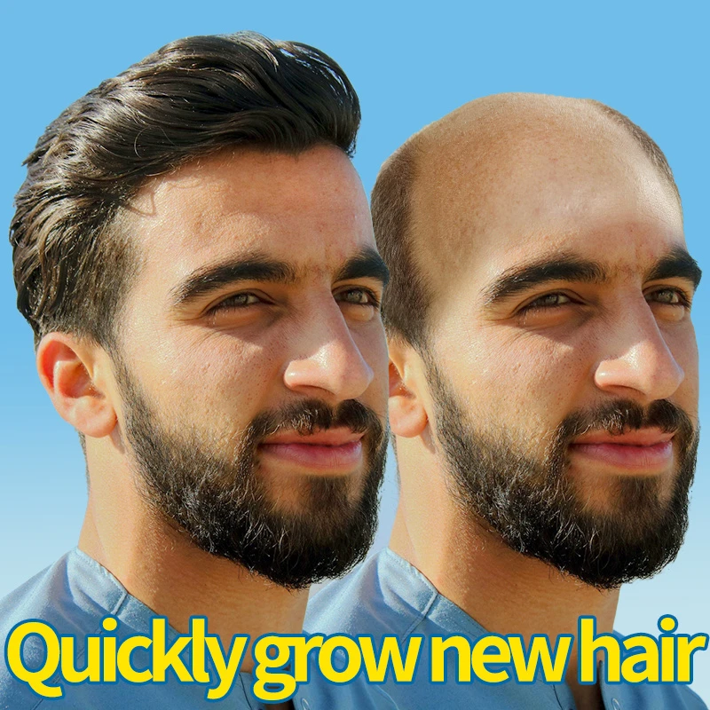 Effective Hairs Regrow Natural Anti Hair Loss Essential Oil Tonic Scalp