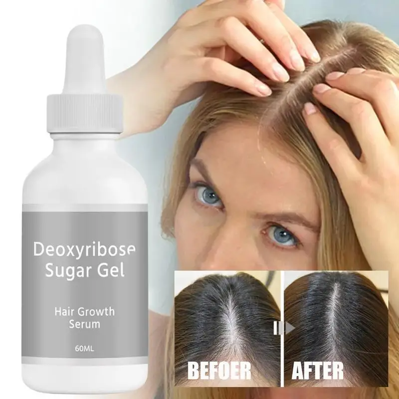Hair Growth Oil 60ml Hair Thickening Gel Deoxyribose Gel for Growth