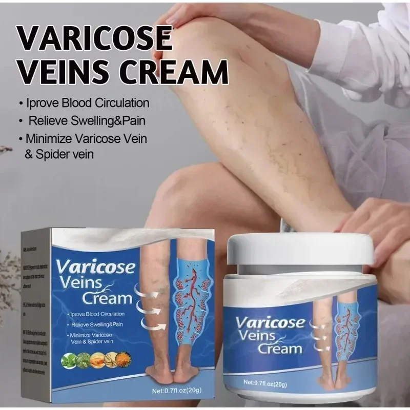 

Крем Sdottor для восстановления варикозного расширения вен, эффективное снятие боли в ногах, крем для лечения боли в сосудах, флебит, средство для удаления вен