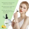 Azelaic Acid Serum Acne Remover Shrinking Pore Invisible Oil Control Brighten Soothing Firm Moisturizing Facial Essence Liquid 3
