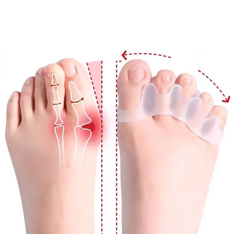 2Pc Silicone Toe Separator Fingers Feet Toe Spreader Hallux Valgus Bunion Corrector Straightener Corrector Finger Separators