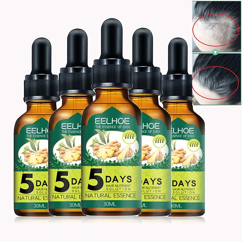 5PCS Gengibre Ess ncia Crescimento Do Cabelo leo Essencial Do Cuidado 