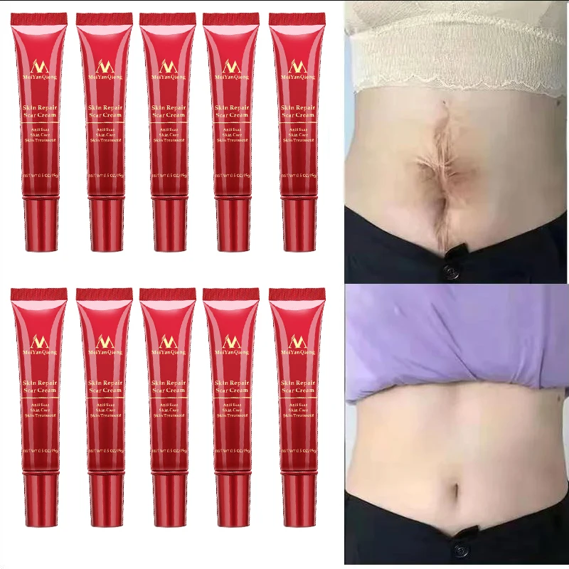 

Scar Removal Cream Gel Remove Acne Spots Treatment Stretch Marks Burn Surgical Scar Repair Cream Smoothing Whitening Skin Beauty