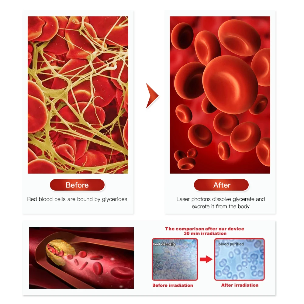 

Laser Acupuncture Therapy For Allergic Rhinitis Hypertension Diabetes Stroke