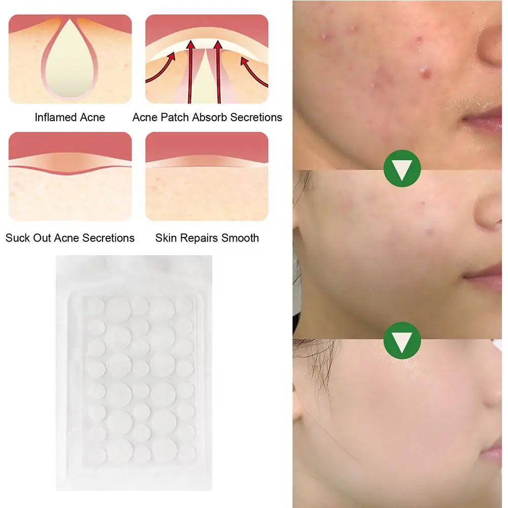 

16/20/24/36PCS Lnvisible Acne Patch Acne Pimple Removal Acne Patch Hydrocolloid Stichers Anti-infection Q1K0