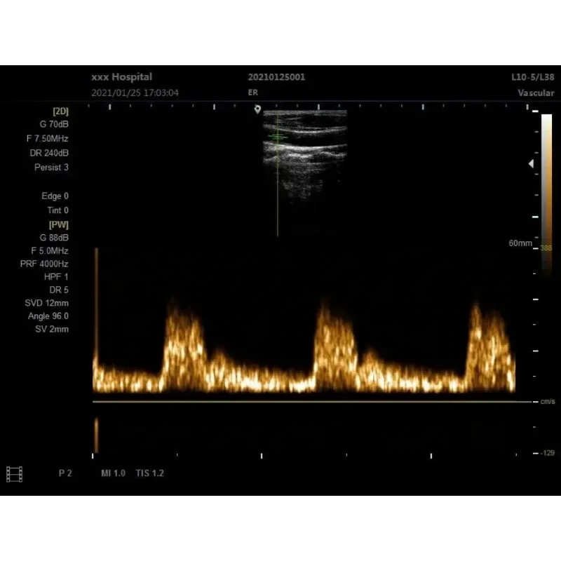 12 Inch Ultrasound Scanner Portable Black White Probe for Horse Cow Dog Portuguese Language XF P20 Veterinary Machine Laptop